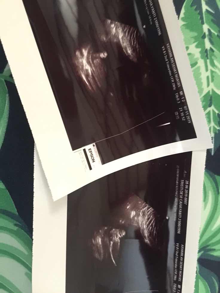 laki2 atau perempuan