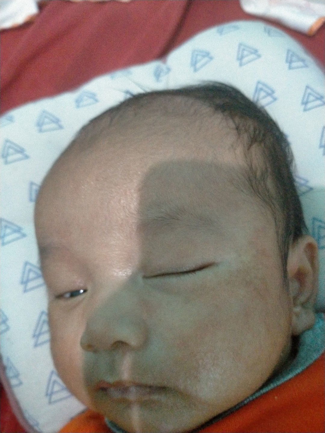 kerak pada bayi