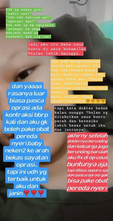 usus buntu uk 22week