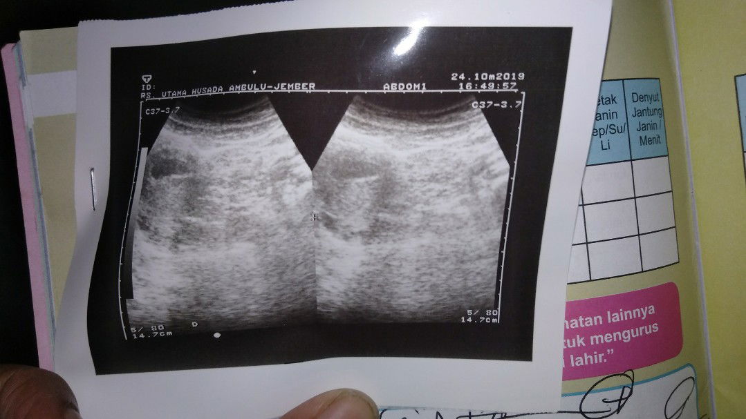 usia kehamilanx brp minggu pd foto hsil usg?