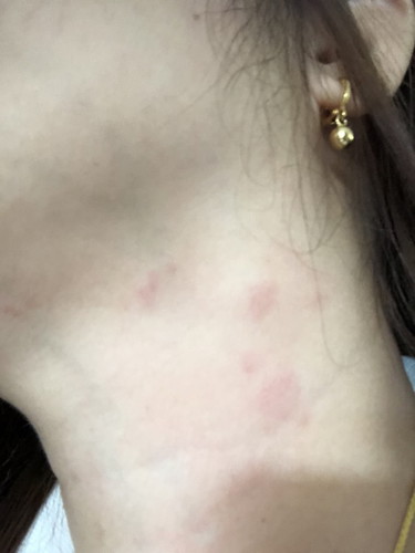 รบกวนสอบถามครับเป็นแบบนี้อันตรายใหมครับ