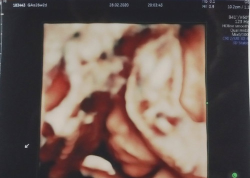 si cantik yang pemalu