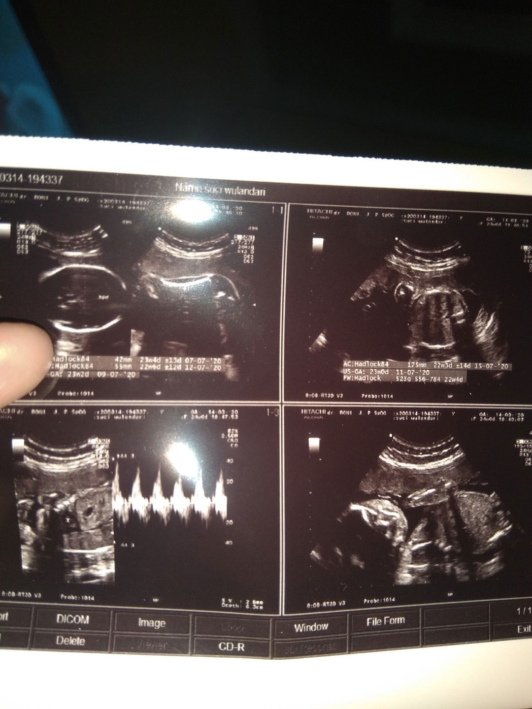 Mohon Sharing Nya Bun