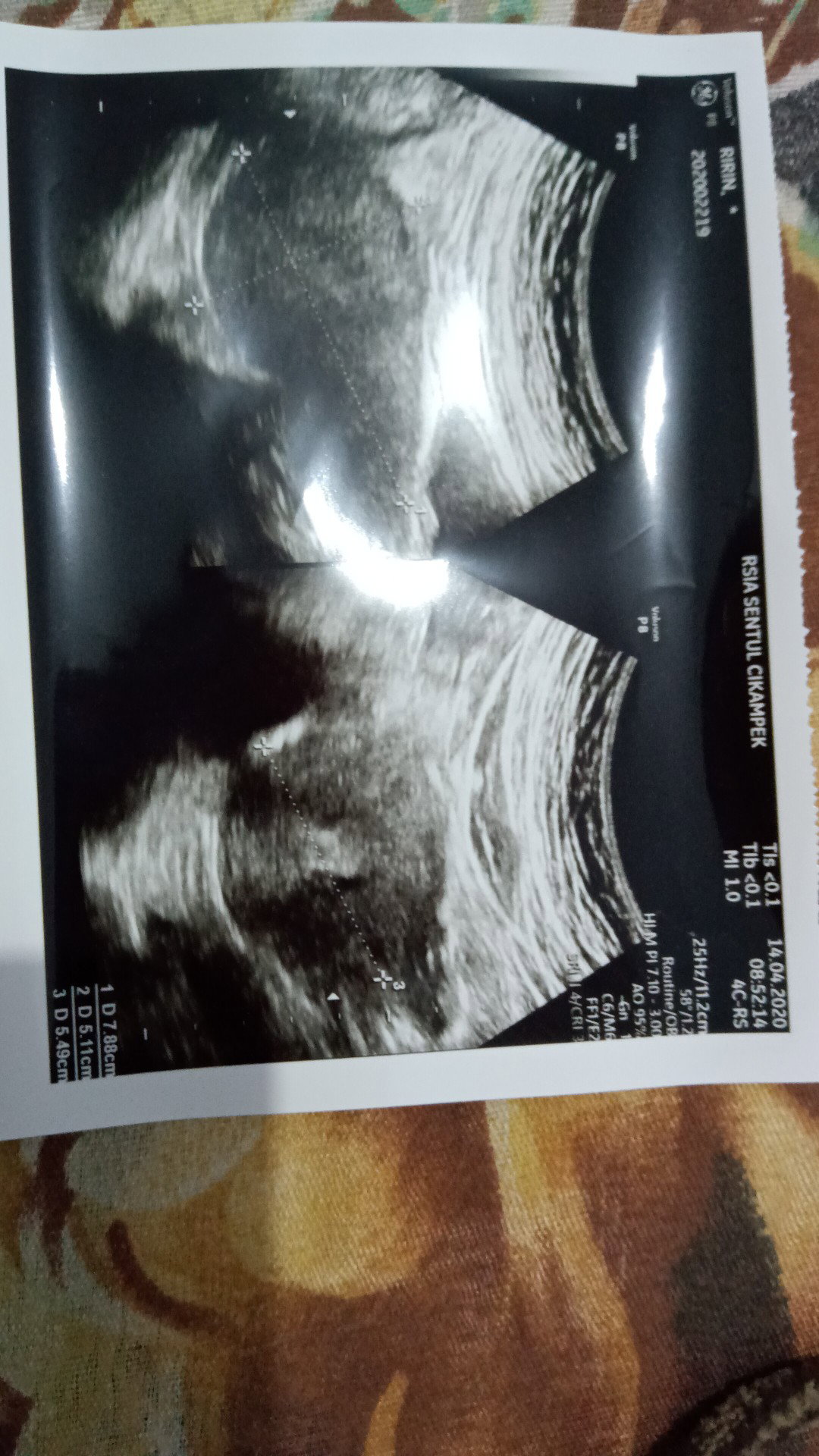 4week