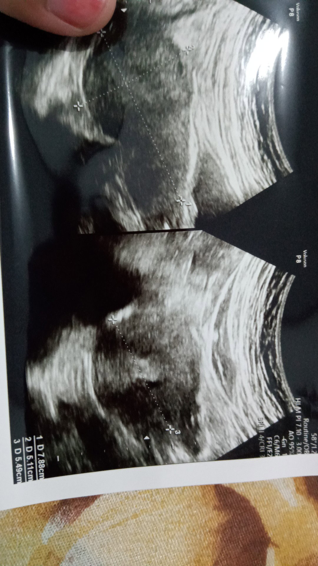 4week5d