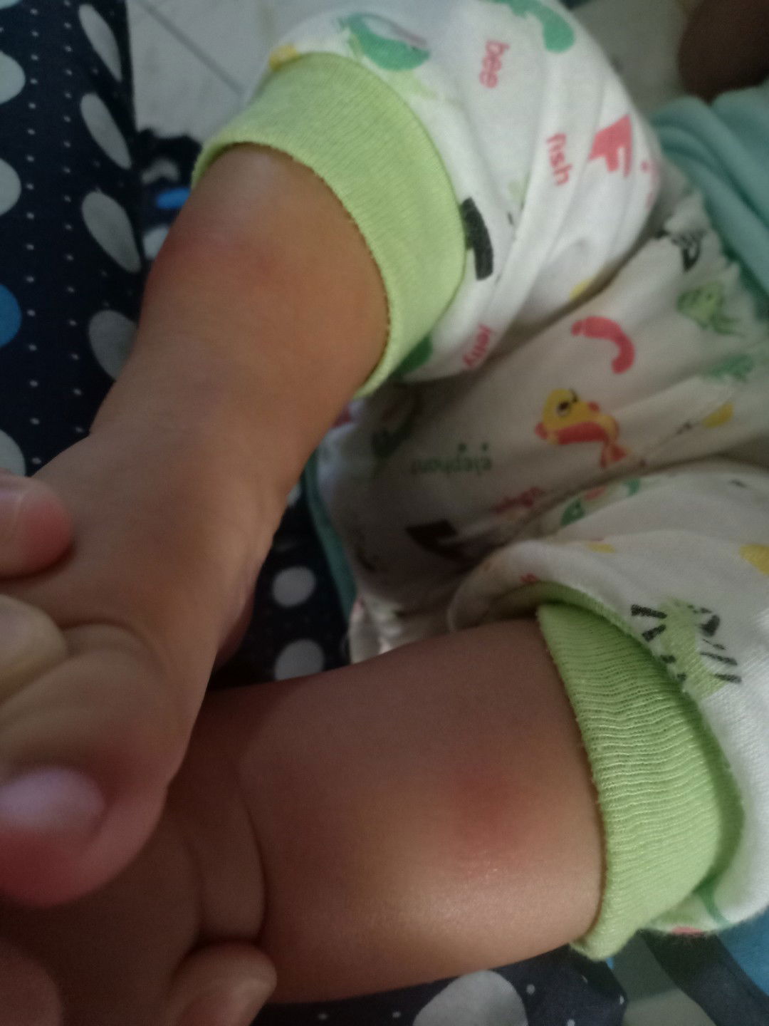 gigitan nyamuk atau apa?