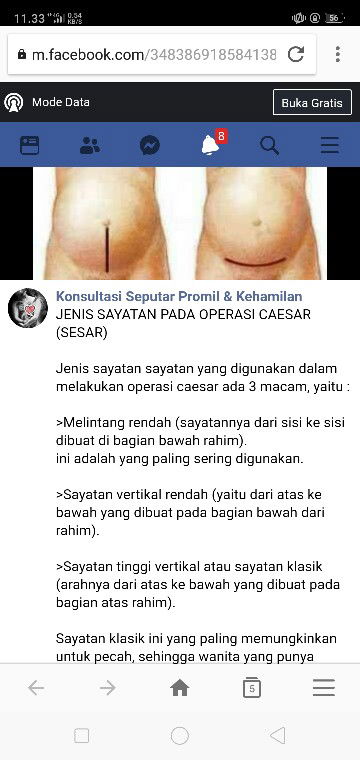 BEKAS OPERASI SC