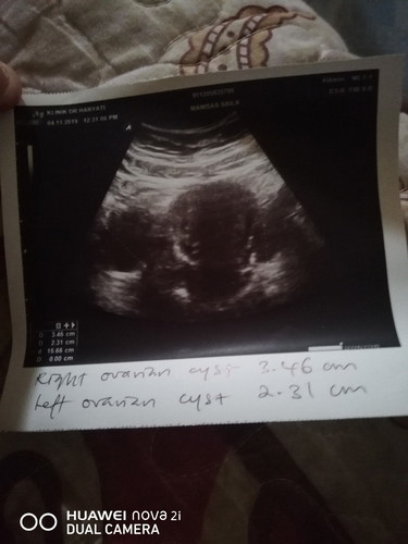 mohon penjelasan ibu2 smua