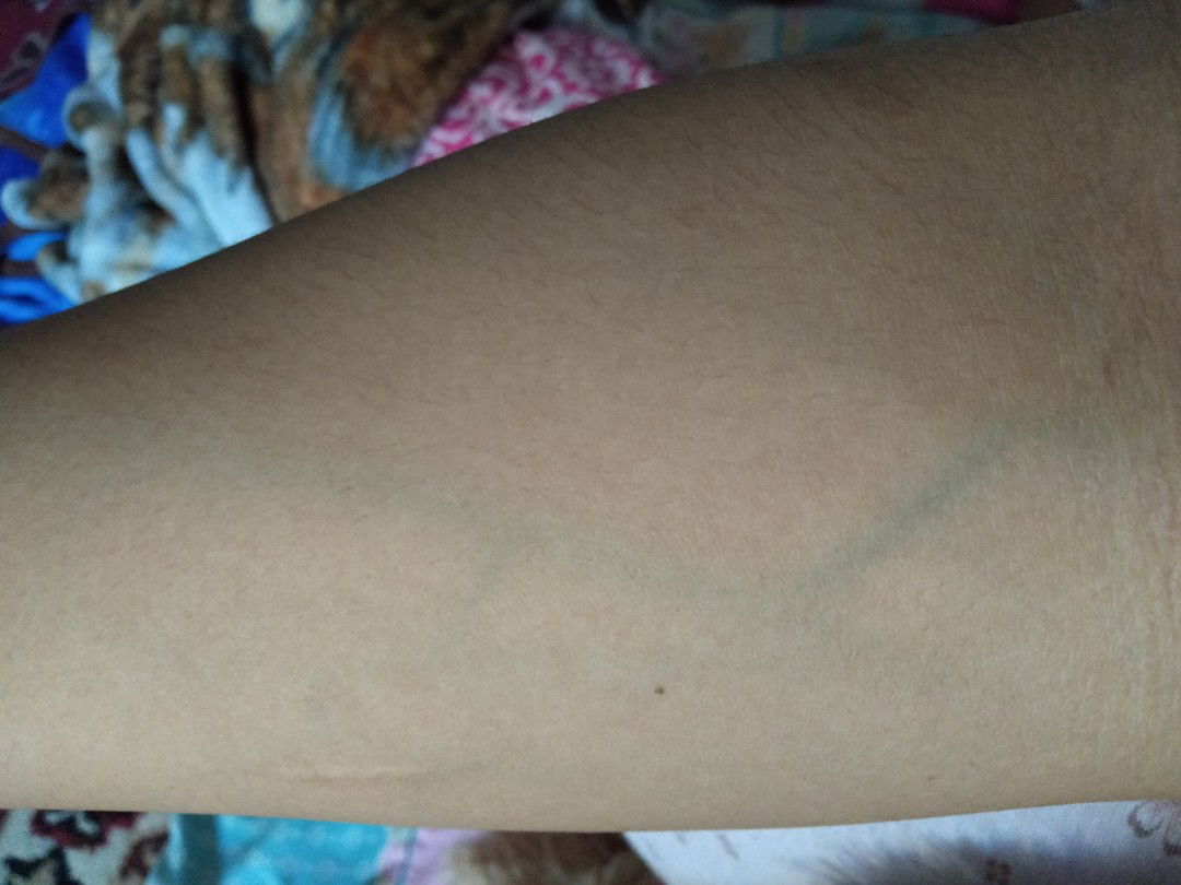 otot2 ditangan dan kaki