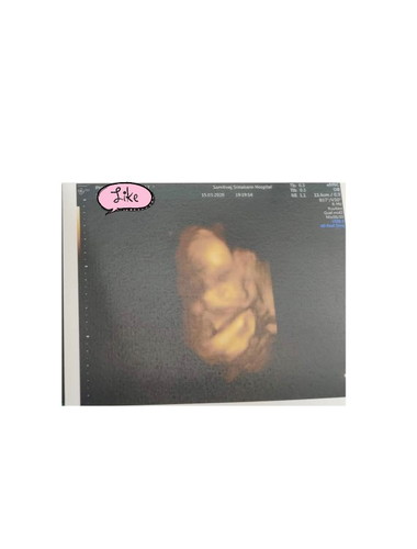 29w1d