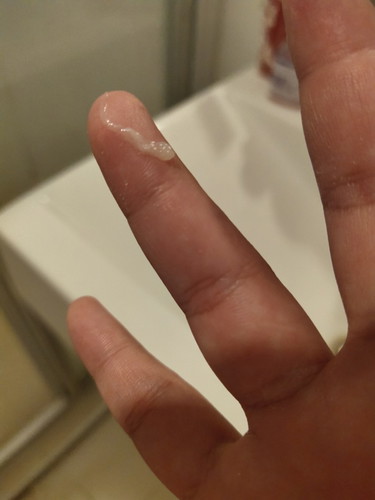 คืออะไร