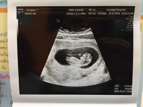 ไปซาวมาเมื่อวาน 10w4d
