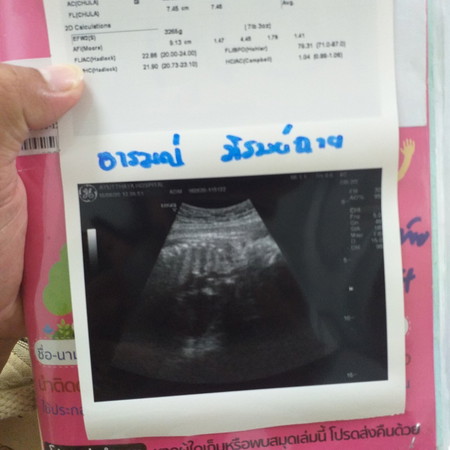 ใกล้ได้เจอหน้ากันแล้ว