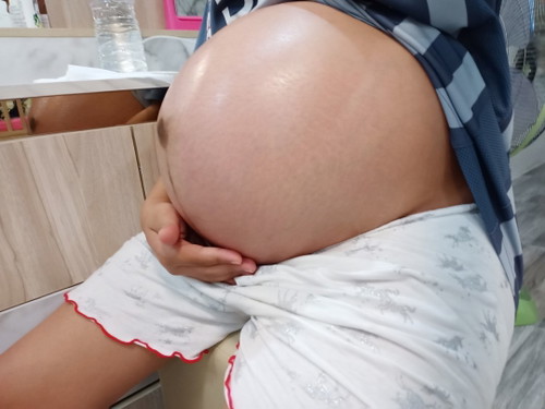 อยากจะแตกแร้ว