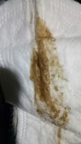 brown discharge