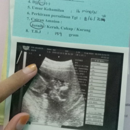 tepat 16 minggu ada yang sama ky aku?