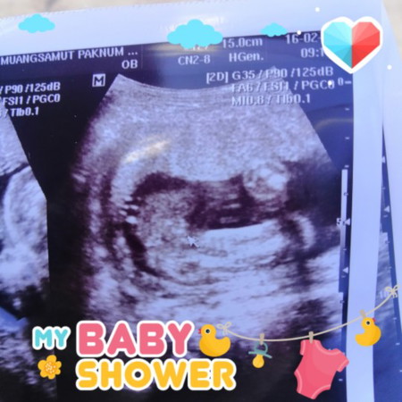 ผช.หรือผญ