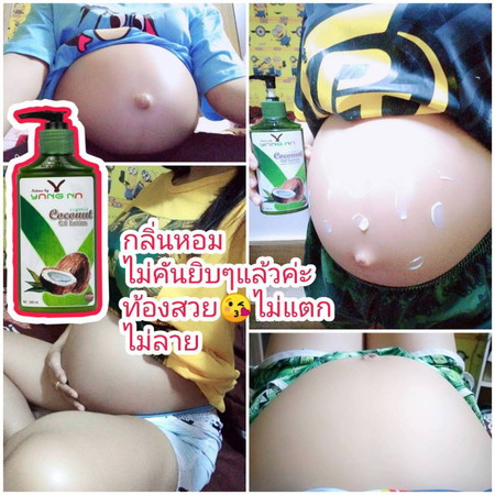 กำหนดผ่า 15 มิถุนายนค่ะ 37 week