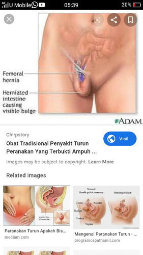 TOLONG TOLONG. SAKIT DI BAHAGIAN V