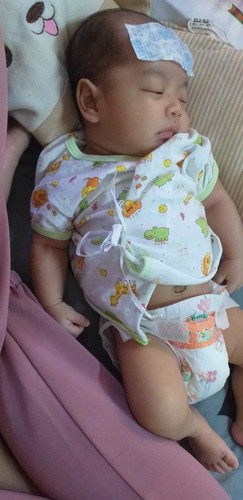 อาการตัวร้อน