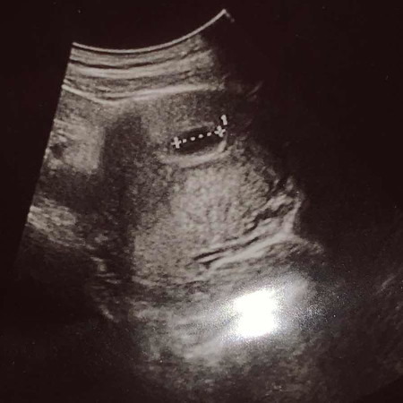 Scan 6w3d