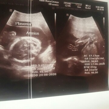 21week