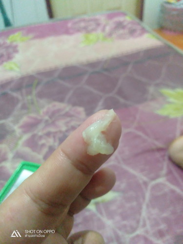 แบบนี้คืออะไรคะ