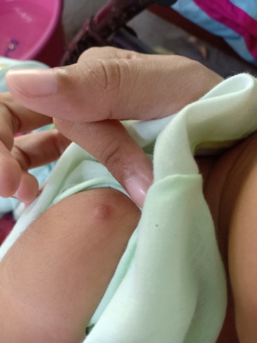 ปลูกฝี