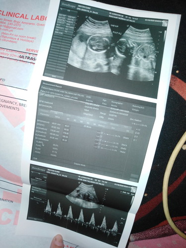 girl or boy??