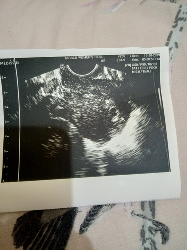 Ultrasound