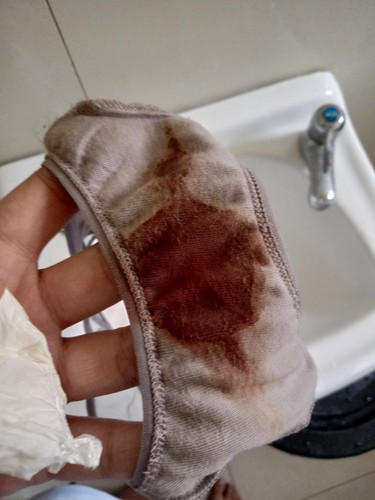Bleeding