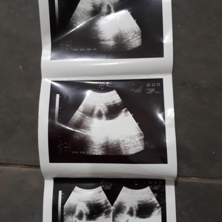 แม่ๆมีใครซาวเจอตัวเด้กเกิน2เดือนไหมค่ะของเรา2เดือนยังไม่เห้นเลยแต่ที่หมอวงไว้คิดว่าน่าจะเป็นเด้กแต่ตัวเล้กมากขอคำแนะนำหน่อยค่ะ