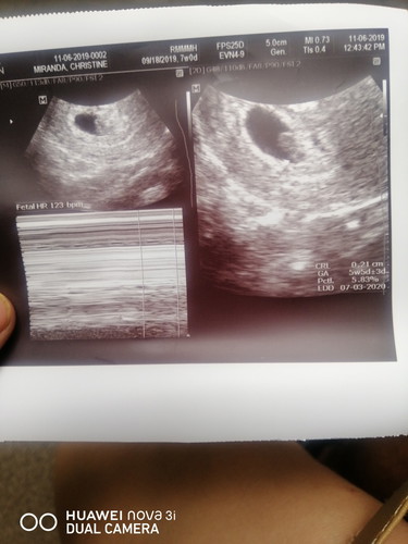 baby