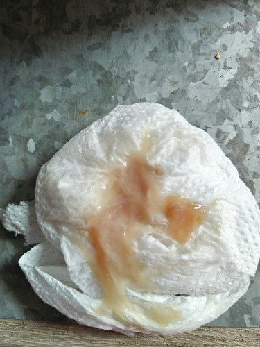 ก่อนคลอด