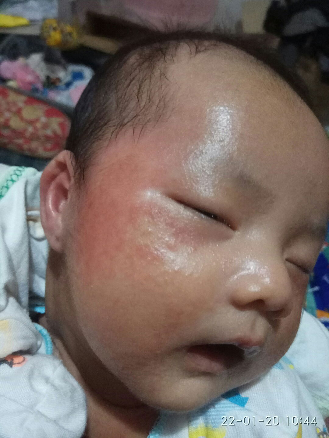 biang keringat atau apa ya