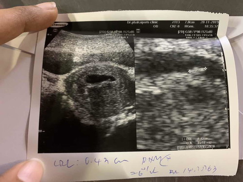 หาตัวเด็กไม่เจอ // เจอถุง2ถุง เป็นถุงเลือดที่อาจจะแท้ง