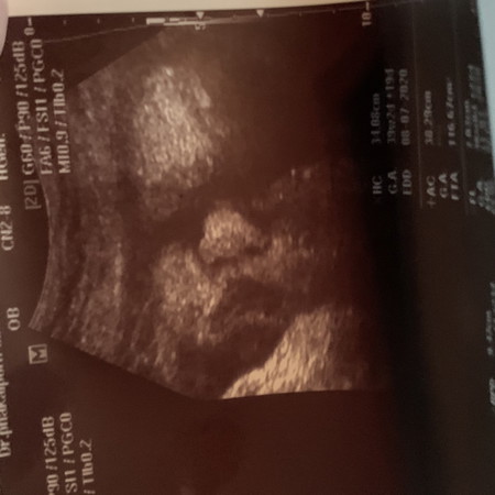 สอบถามแม่ๆหน่อยค่า เด็ก 4042 g