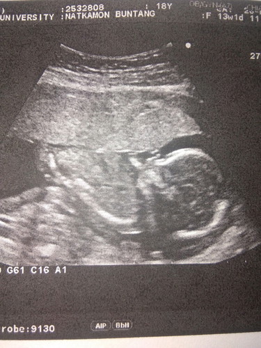 อยากทราบว่า