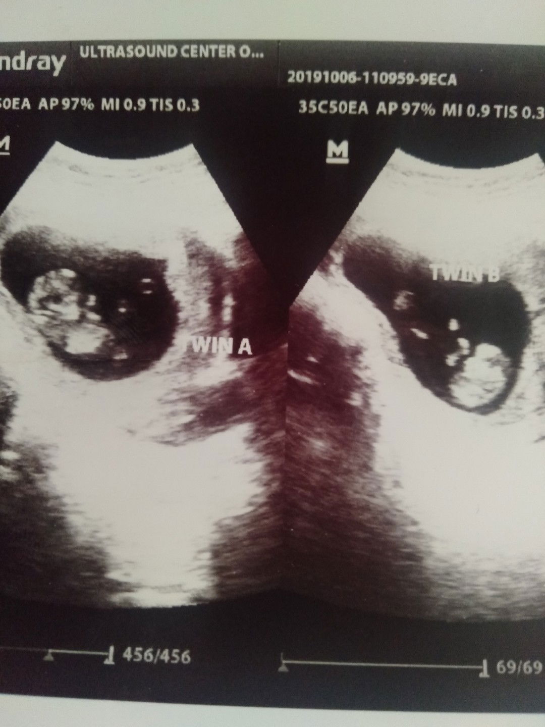 ano po magandang name para sa baby ko pong twin qng  baby boy cla or baby girl oh di kaya boy'girl ng twin..? initial letter R and J