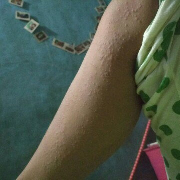Gatalll..