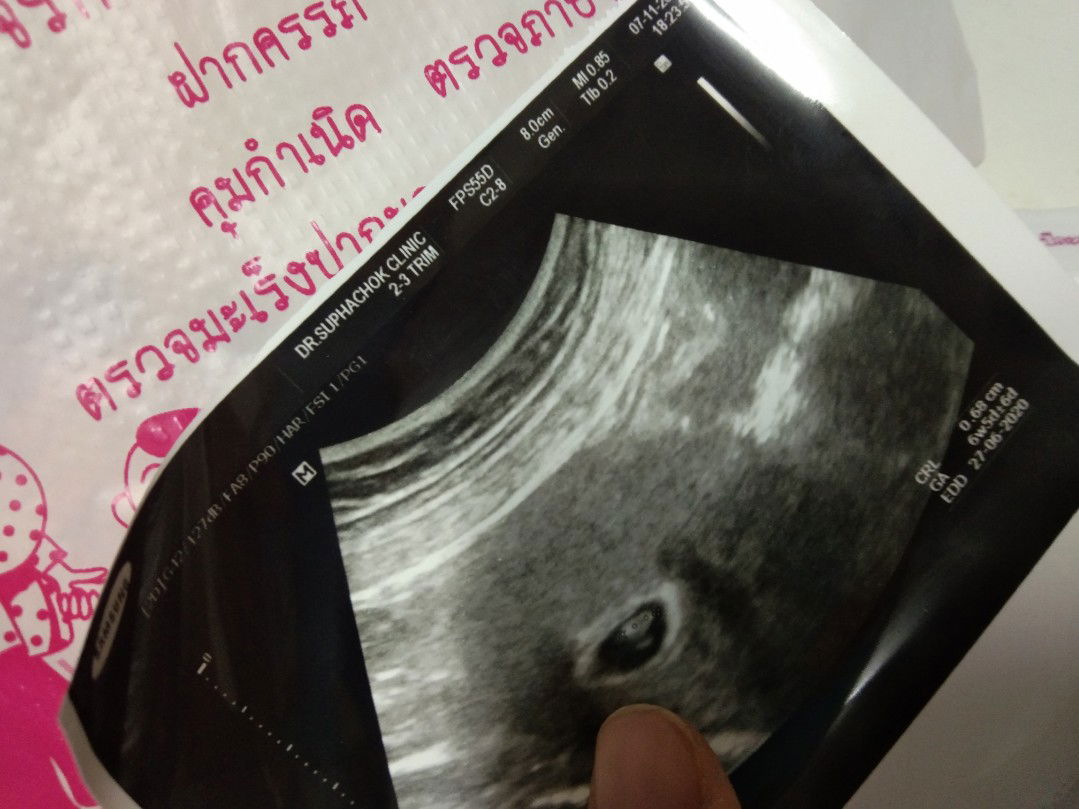 thanchanok buttanu profile icon