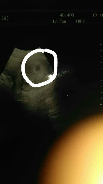 MASYA ALLAH TABARAKALLAH 6week