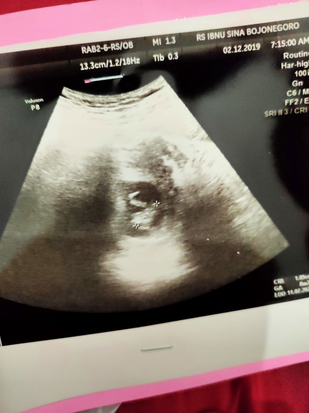 ukuran janin