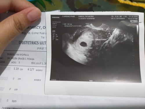 pregnancy