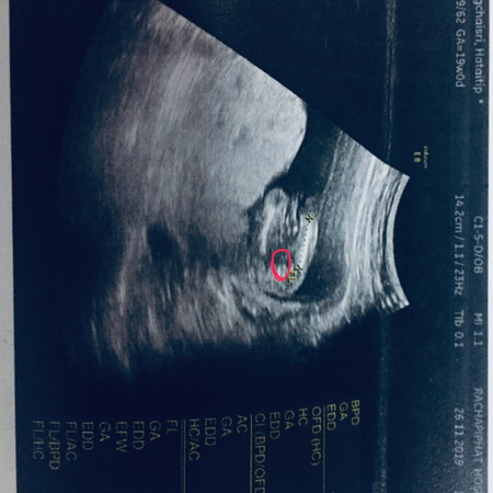 ญ หรือ ช