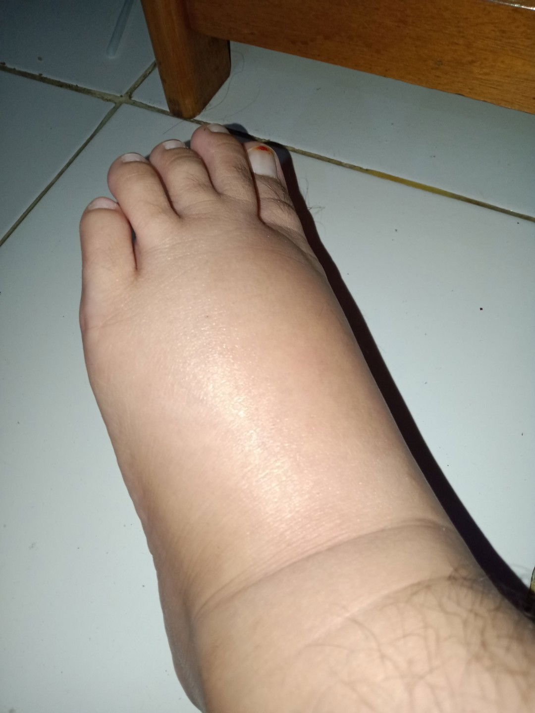kaki membengkak saat hamil