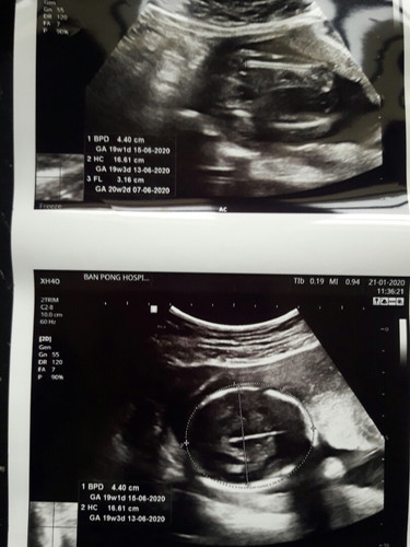 ใบซาวด์