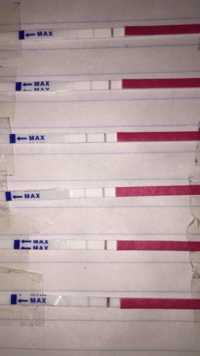OPK