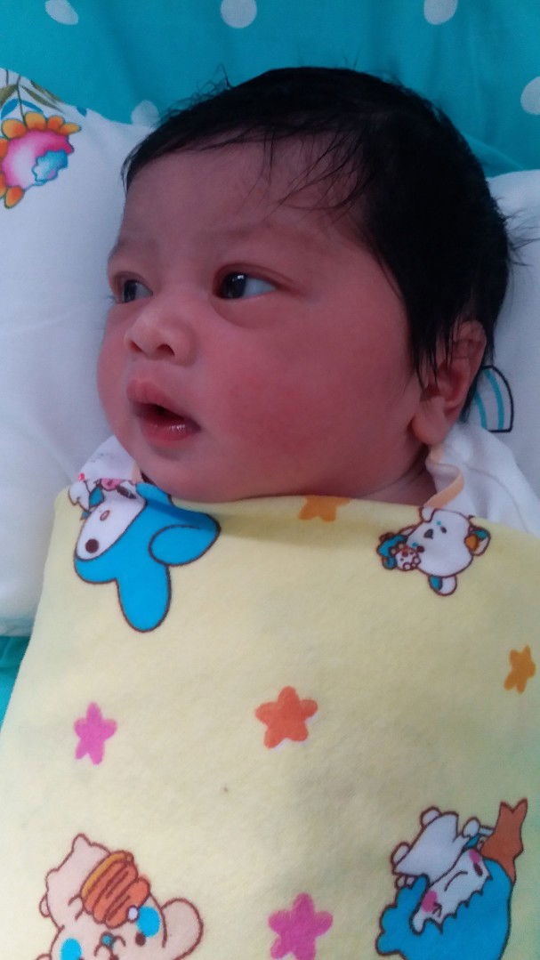 rambut tebal dari lahir...tpi gk boleh disisir