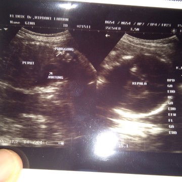 UK normal brp minggu bun ???